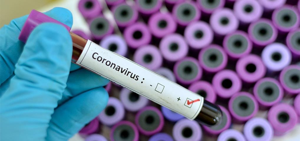 Teste para Coronavirus