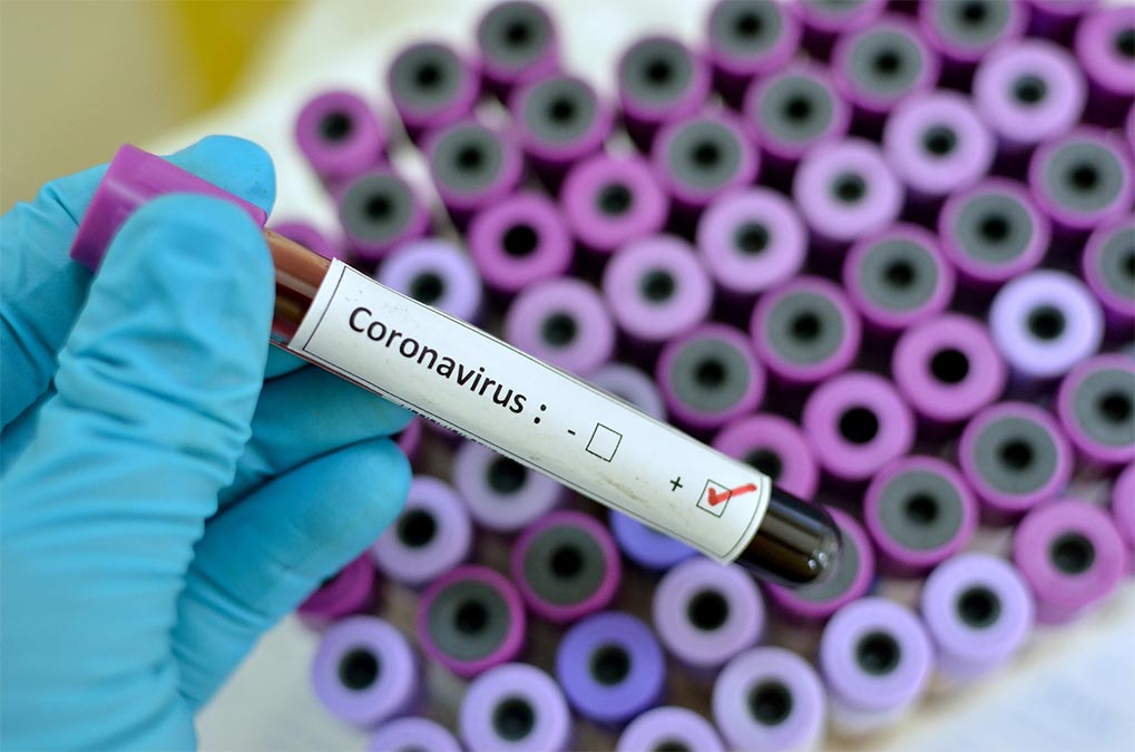Teste para Coronavirus