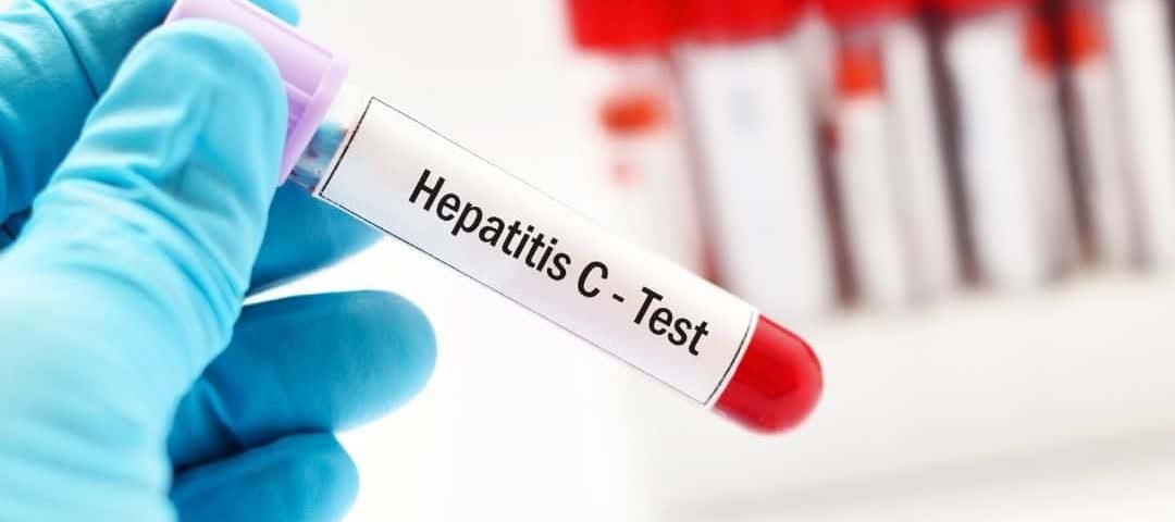 Portaria SCTIE-MS nº 32 institui testagem universal para hepatite viral c em gestantes no pré-natal