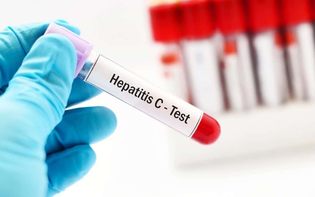Portaria SCTIE-MS nº 32 institui testagem universal para hepatite viral c em gestantes no pré-natal