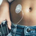 Novos critérios para fornecimento de bomba de insulina por planos de saúde.