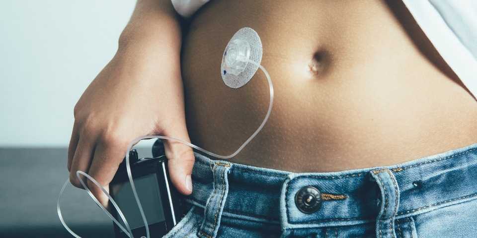 Novos critérios para fornecimento de bomba de insulina por planos de saúde.